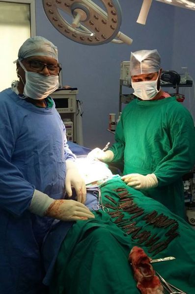 Des chirurgiens indiens ont retiré 40 couteaux de l’estomac d’un homme de 42 ans.
